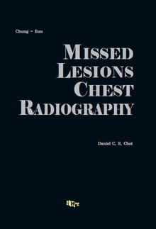 MISSED LESIONS CHEST RADIOGRAPHY