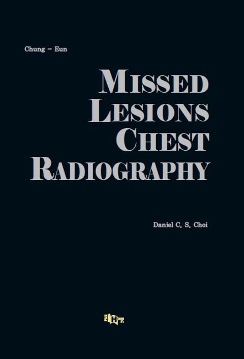 MISSED LESIONS CHEST RADIOGRAPHY 표지 이미지