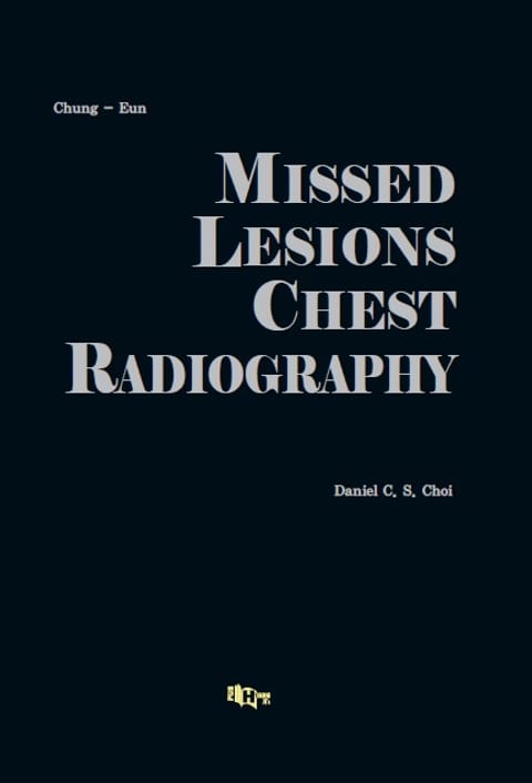 MISSED LESIONS CHEST RADIOGRAPHY 표지 이미지