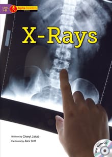 X-Rays