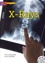 X-Rays