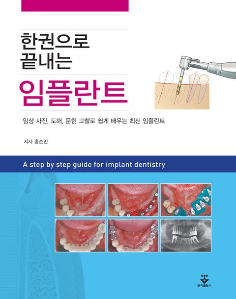 한권으로 끝내는 임플란트 표지 이미지