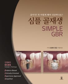 심플 골재생 (SIMPLE GBR)