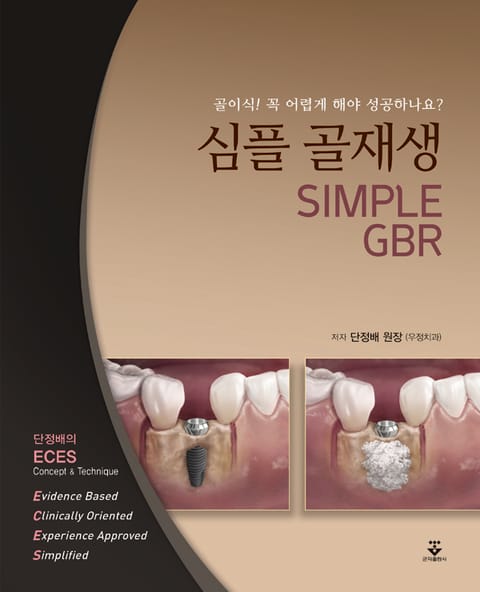 심플 골재생 (SIMPLE GBR) 표지 이미지