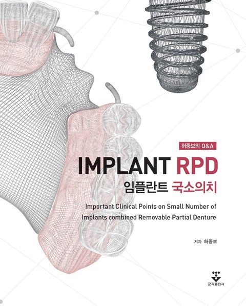 허중보의 Q&A 임플란트 국소의치 (Implant RPD) 표지 이미지