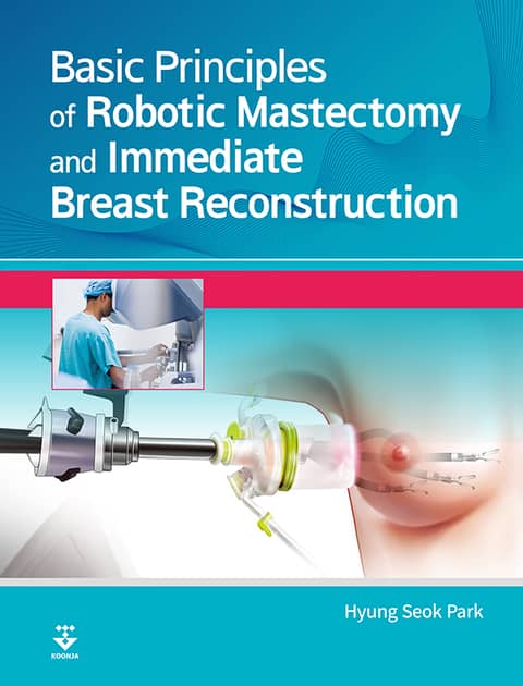 Basic Principles of Robotic Mastectomy and Immediate Breast Reconstruction 표지 이미지