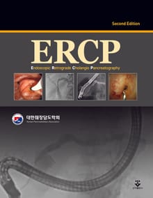 개정2판 | ERCP
