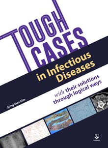 Tough Cases in Infectious Diseases with their solutions through logical ways