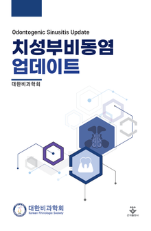 치성부비동염 업데이트