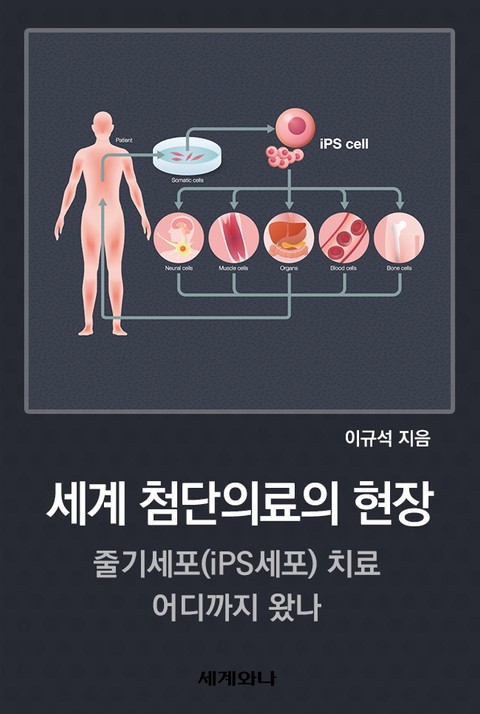 세계 첨단의료의 현장 : 줄기세포(iPS세포) 치료 어디까지 왔나 표지 이미지