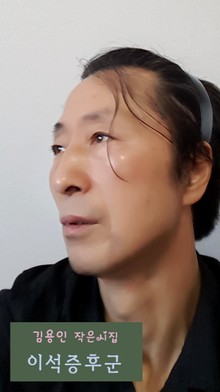 이석증후군