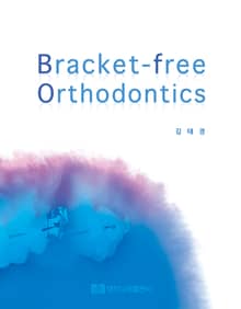 Bracket-free Orthodontics