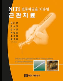 NiTi 전동파일을 이용한 근관치료