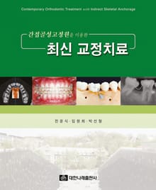 간접골성고정원을 이용한 최신 교정치료