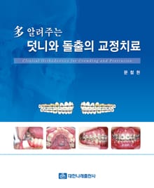 다 알려주는 덧니와 돌출의 교정치료