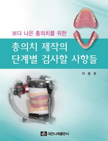 보다 나은 총의치를 위한 총의치 제작의 단계별 검사할 사항들