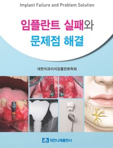 임플란트 실패와 문제점 해결
