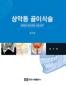 상악동 골이식술 제2판