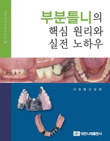 부분틀니의 핵심 원리와 실전 노하우
