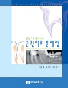 문답으로 풀어보는 근관치료 문제점