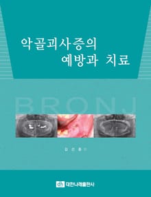 악골괴사증의 예방과 치료