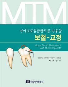 마이크로-임플란트를 이용한 보철-교정