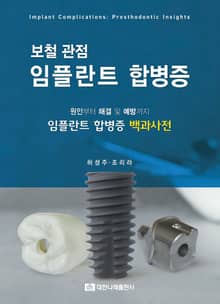 보철 관점 임플란트 합병증