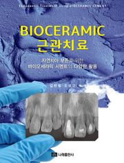 BIOCERAMIC 근관치료