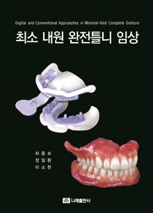 최소 내원 완전틀니 임상