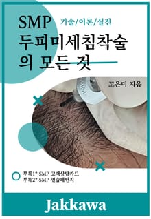 SMP 두피미세침착술의 모든 것