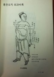 외과비록 통천오지 1-4권
