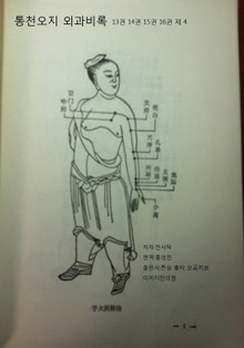 외과비록 통천오지 13-16권