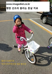 팽창 선조라 불리는 튼살 치료