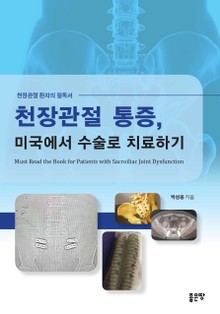 천장관절 통증, 미국에서 수술로 치료하기