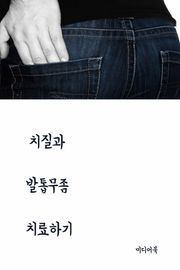 치질과 발톱무좀 치료하기 (국민건강 대체의학)