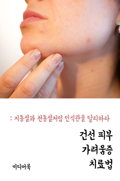 건선 피부 가려움증 치료법 (지동설과 천동설처럼 인식관을 달리하라) 표지 이미지